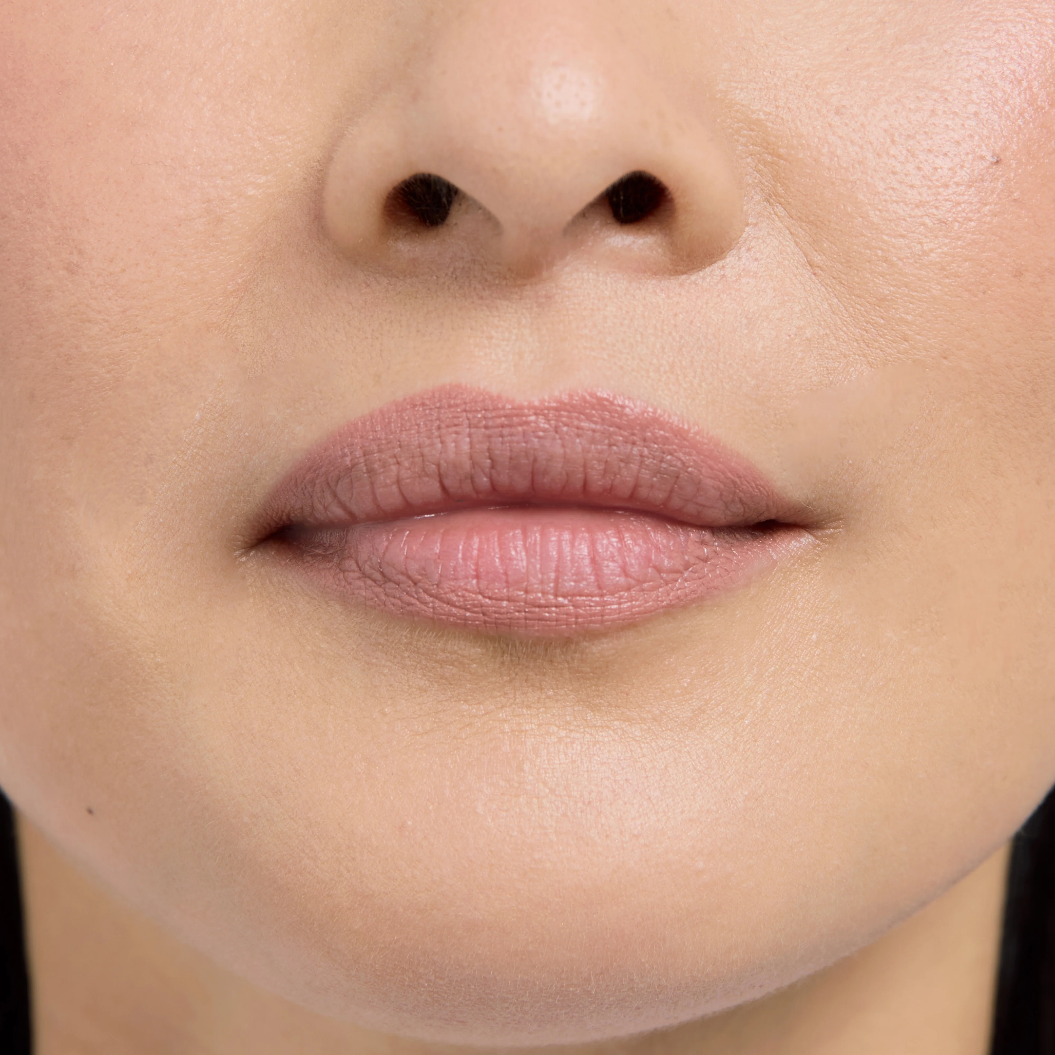 Lip Frame - Image 15