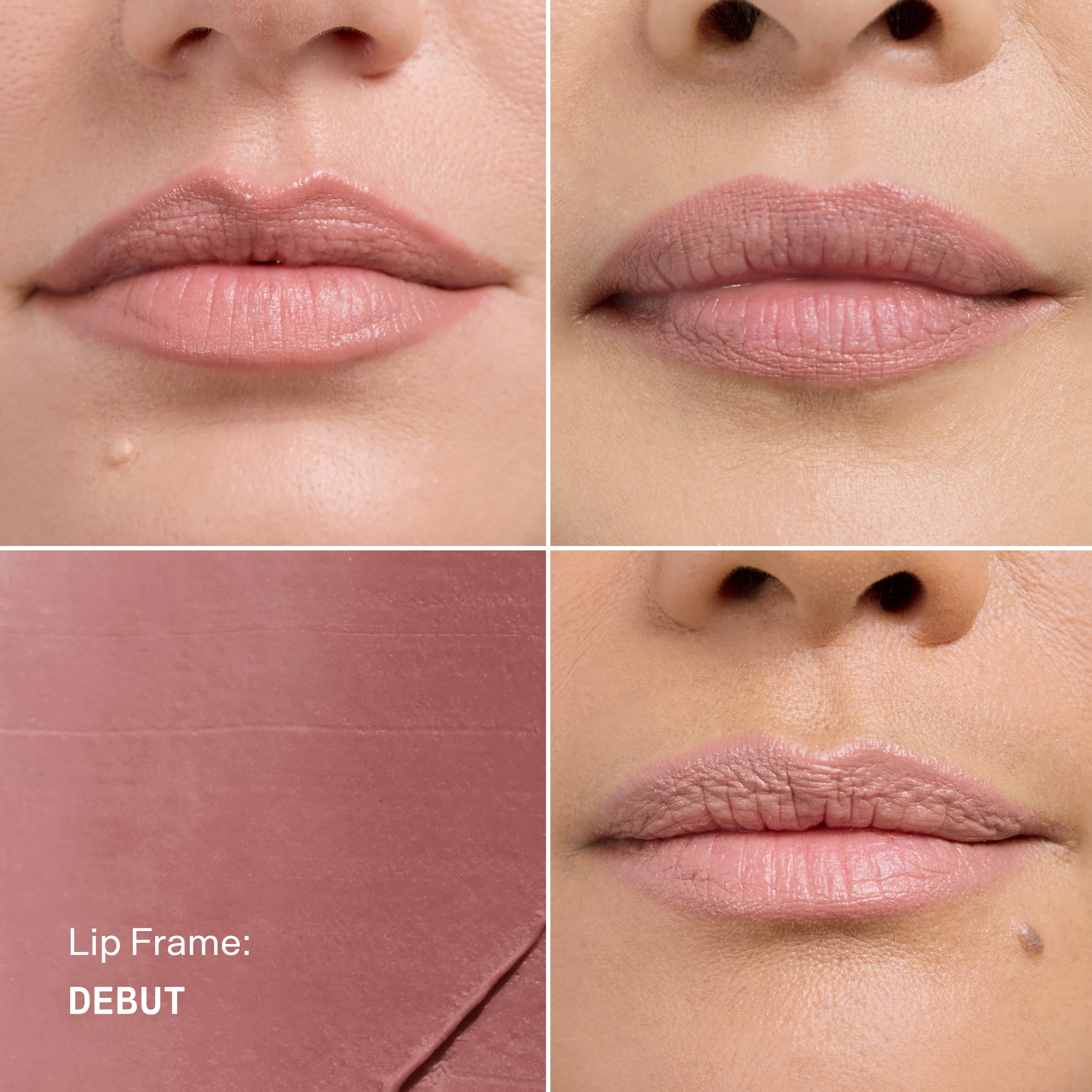 Lip Frame - Image 21