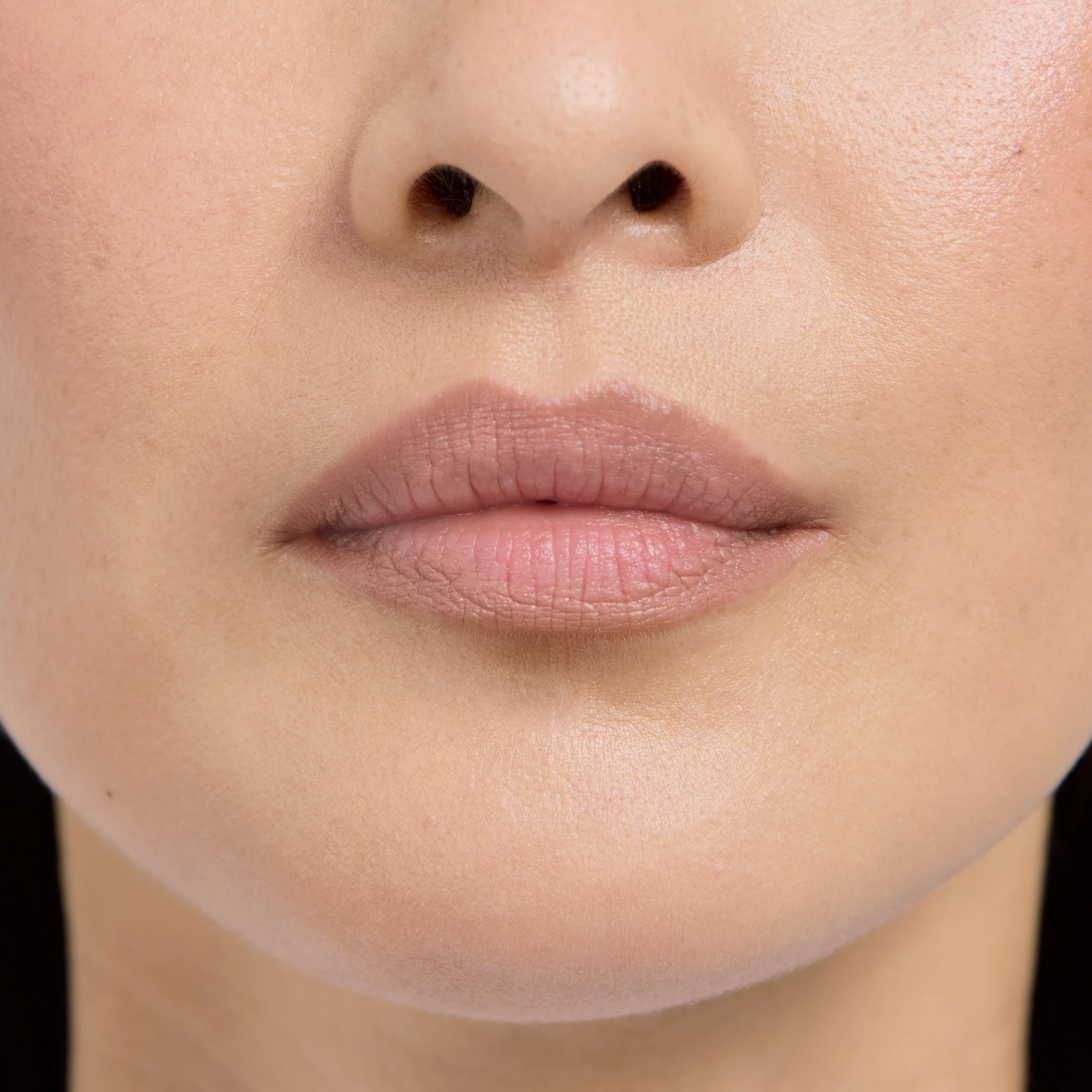 Lip Frame - Image 27