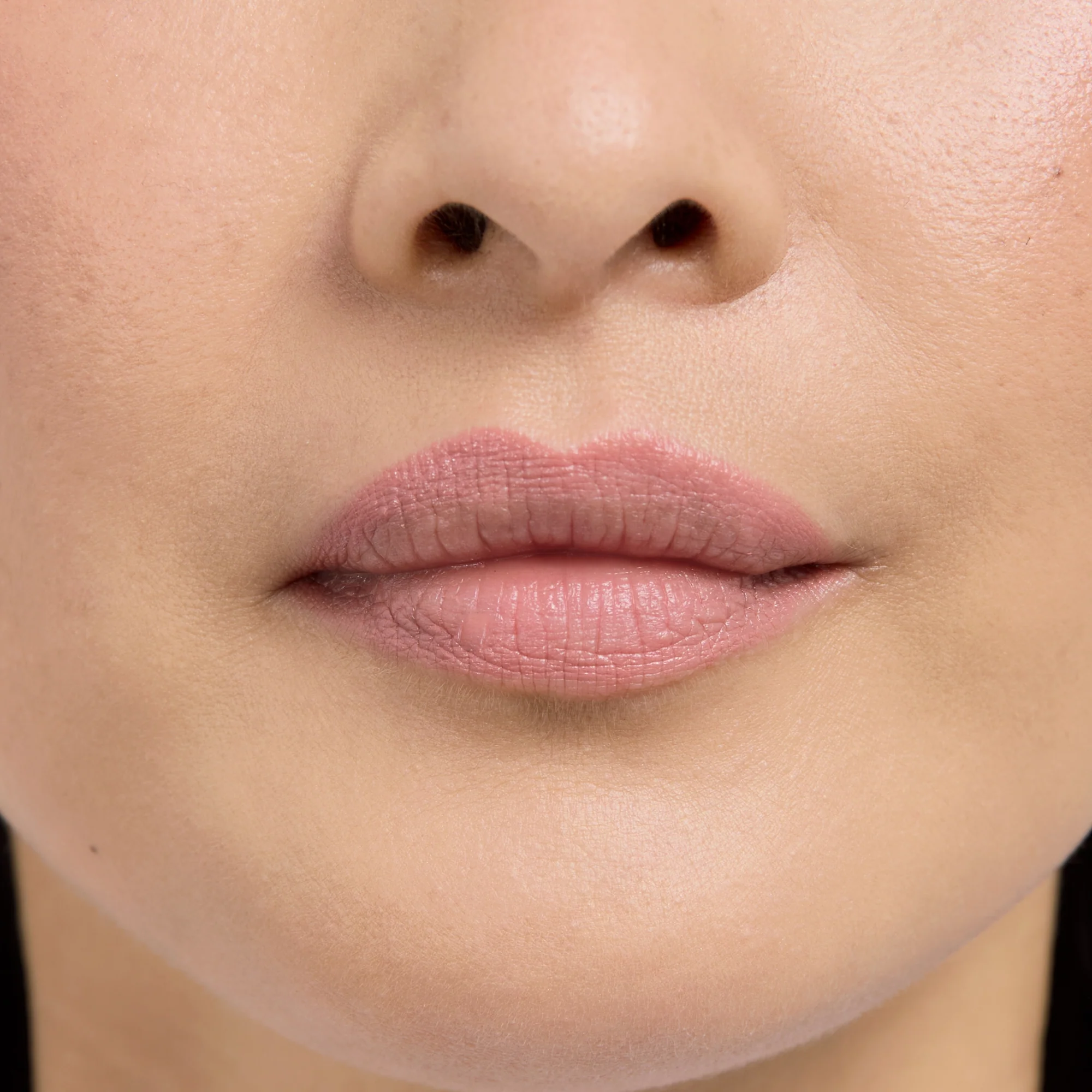 Lip Frame - Image 3