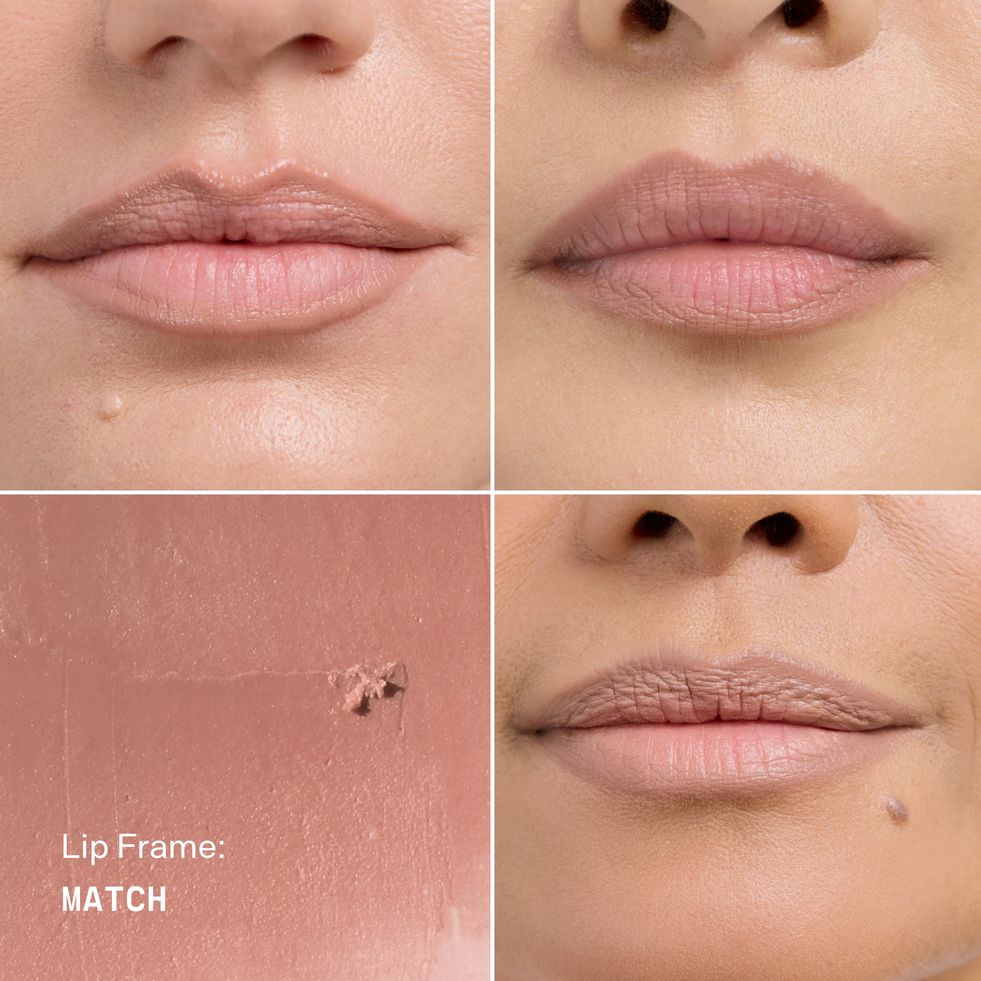 Lip Frame - Image 33