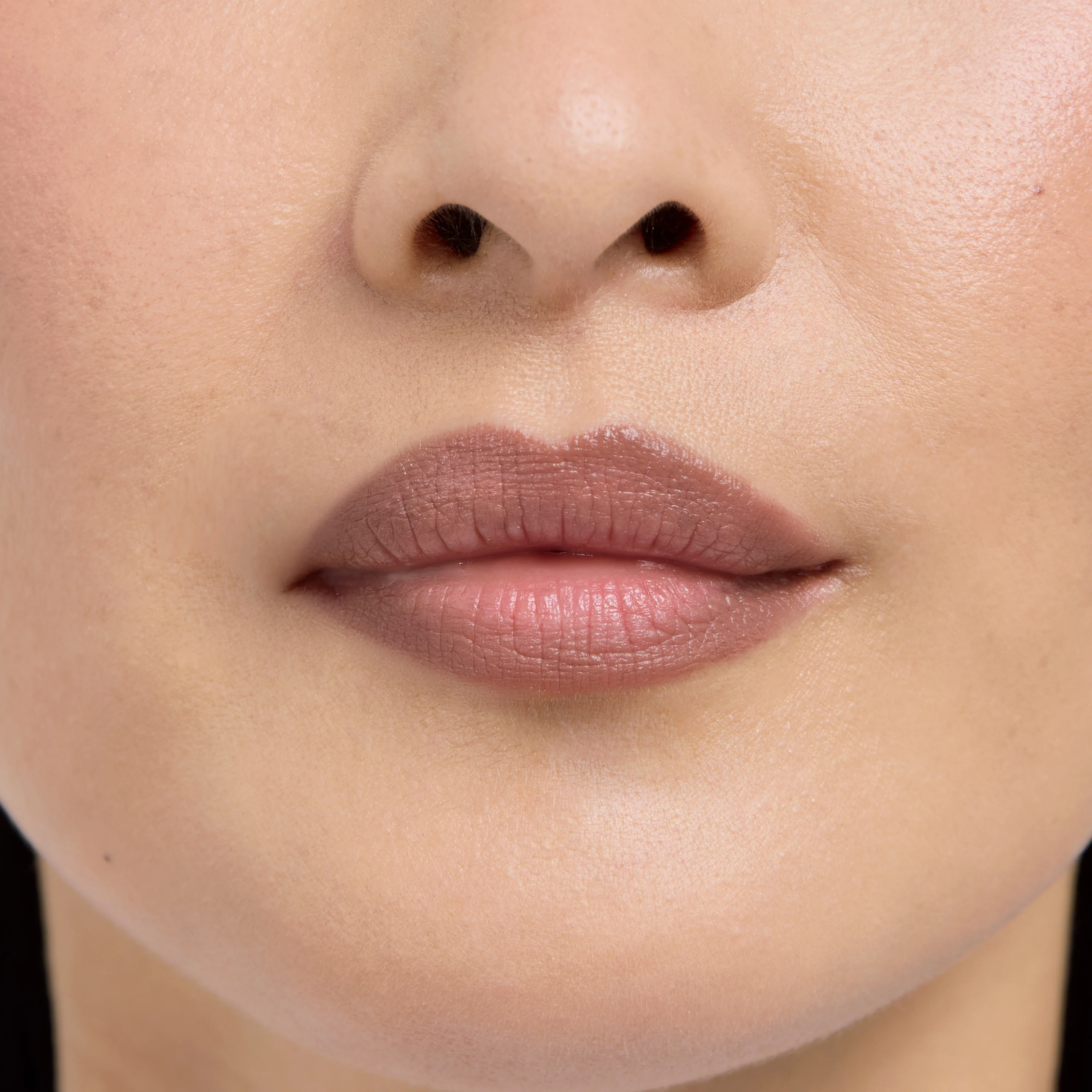 Lip Frame - Image 51