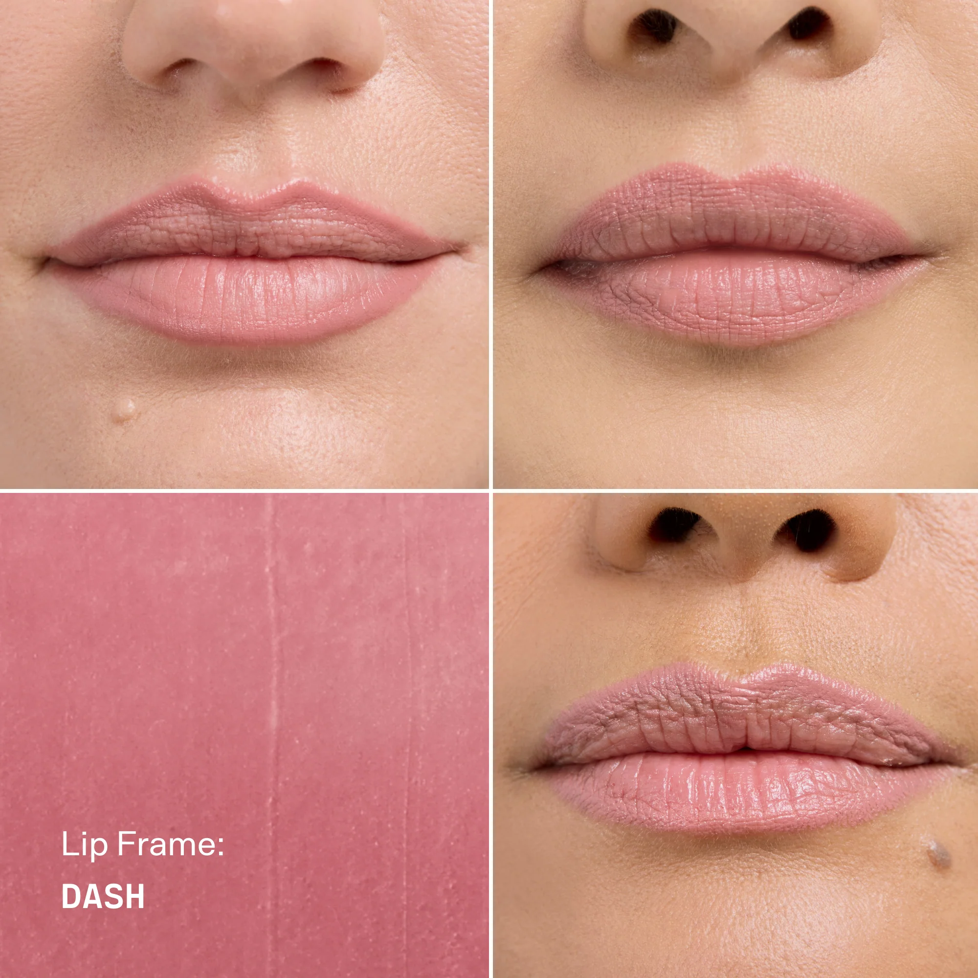 Lip Frame - Image 9