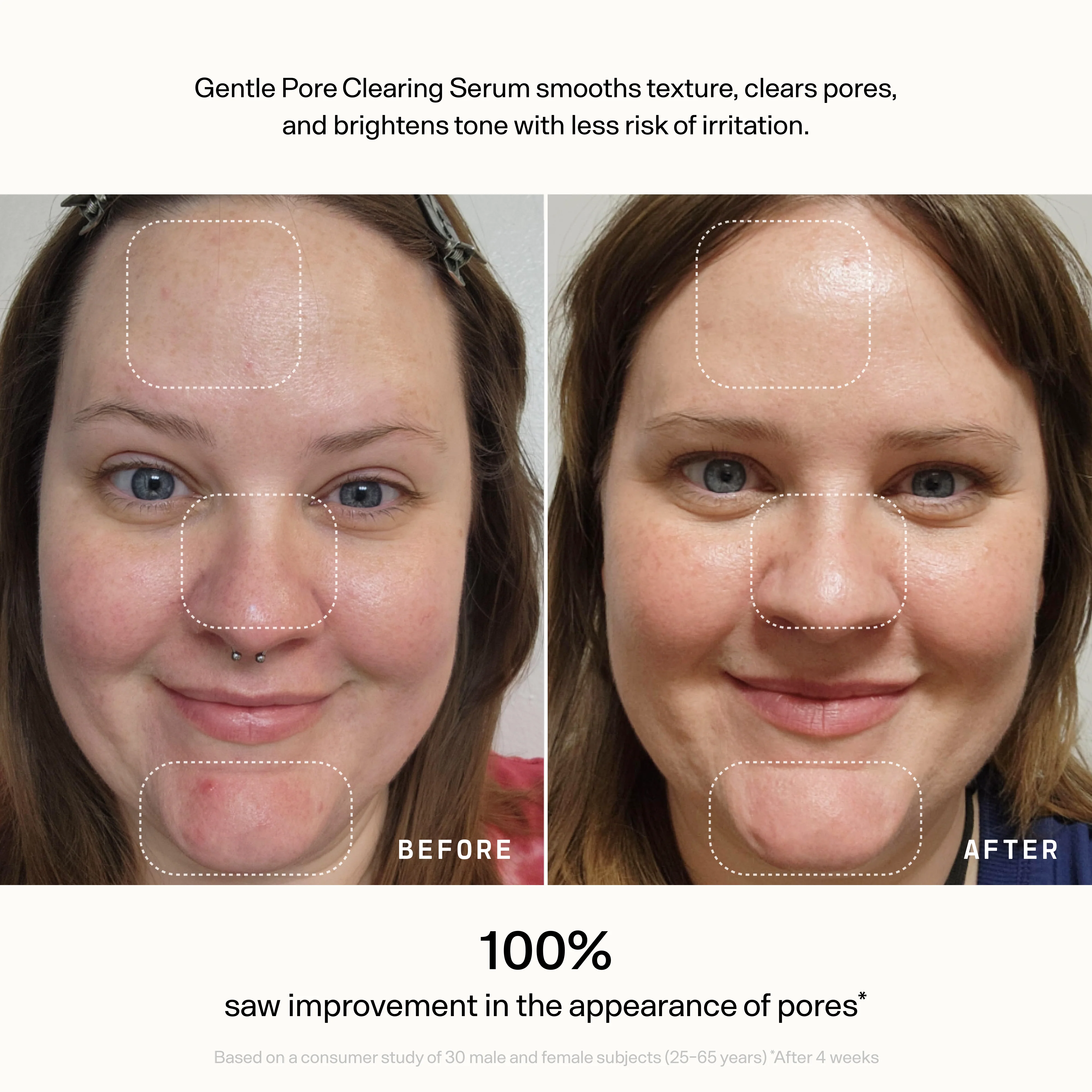 Skin Refine - Image 6