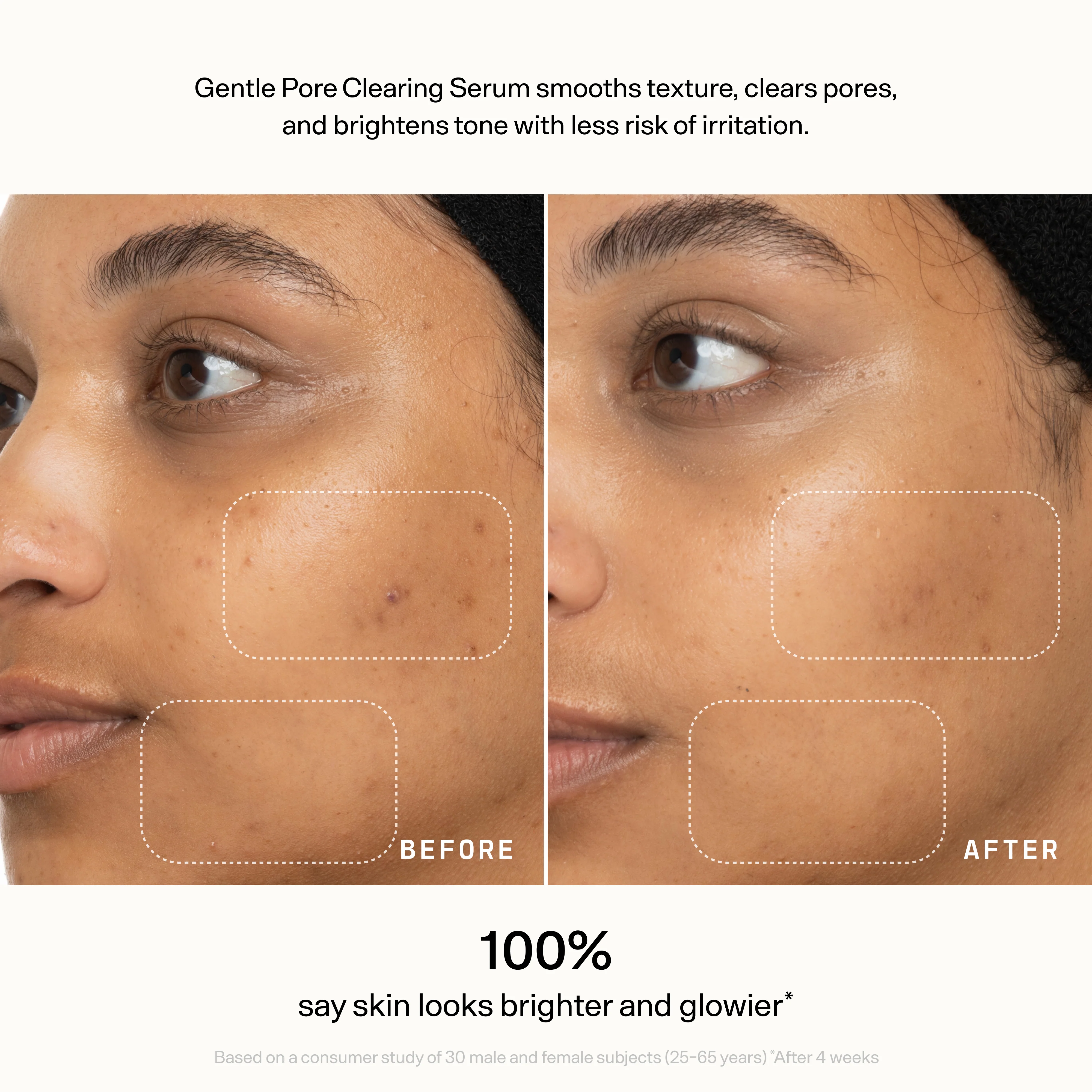 Skin Refine - Image 7