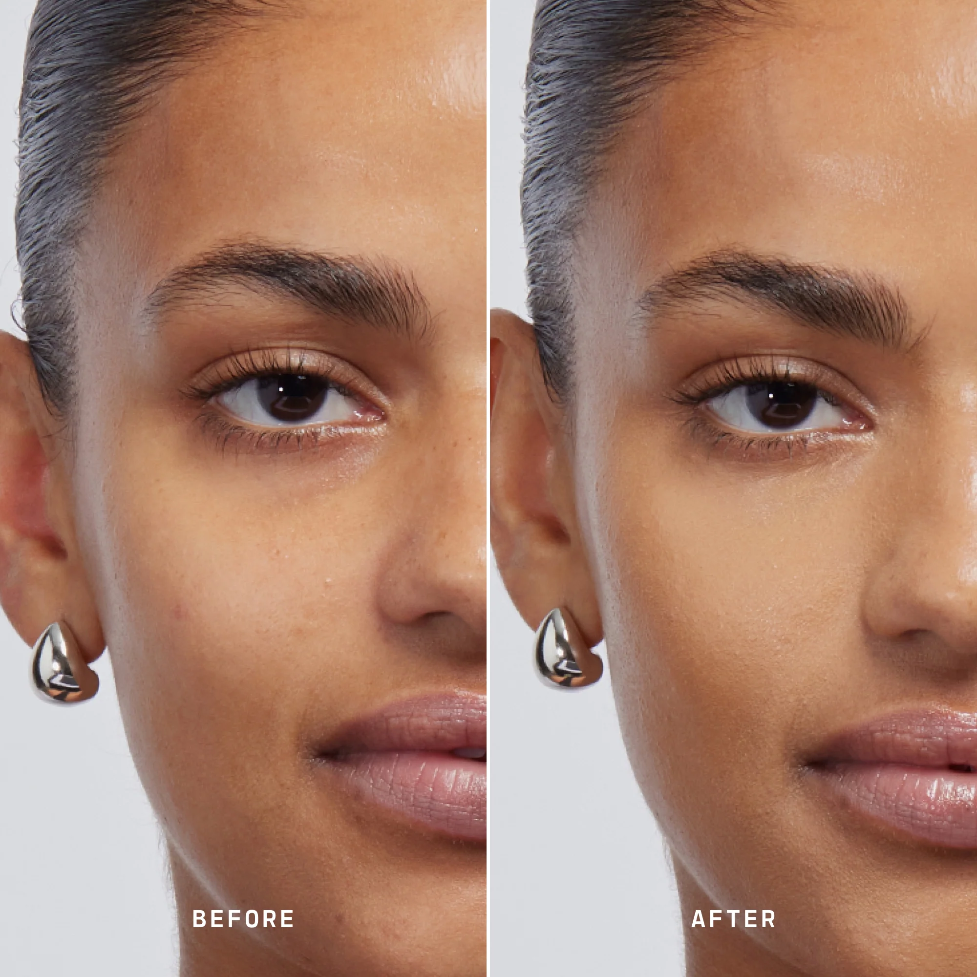 Skin Solution - Image 115