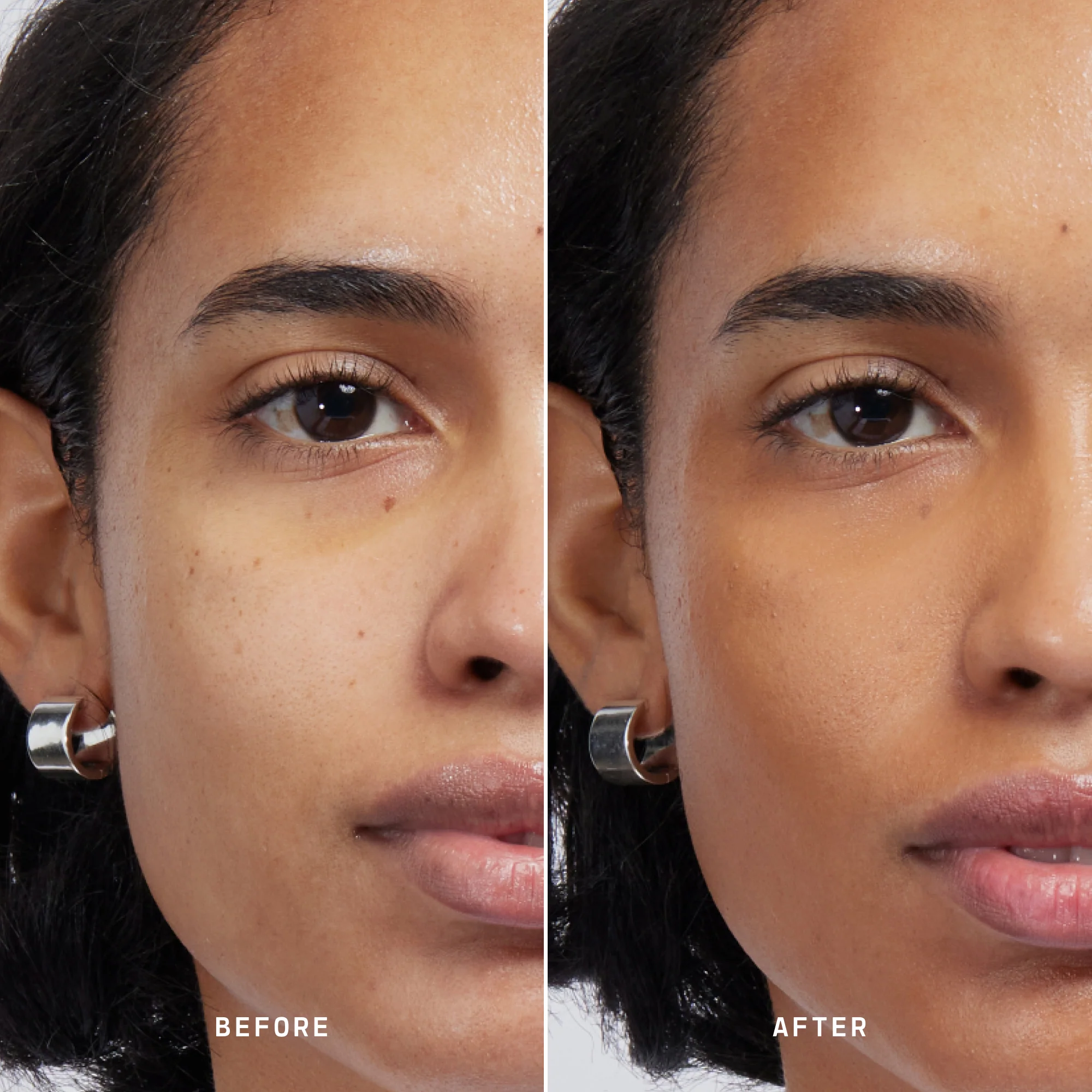 Skin Solution - Image 143