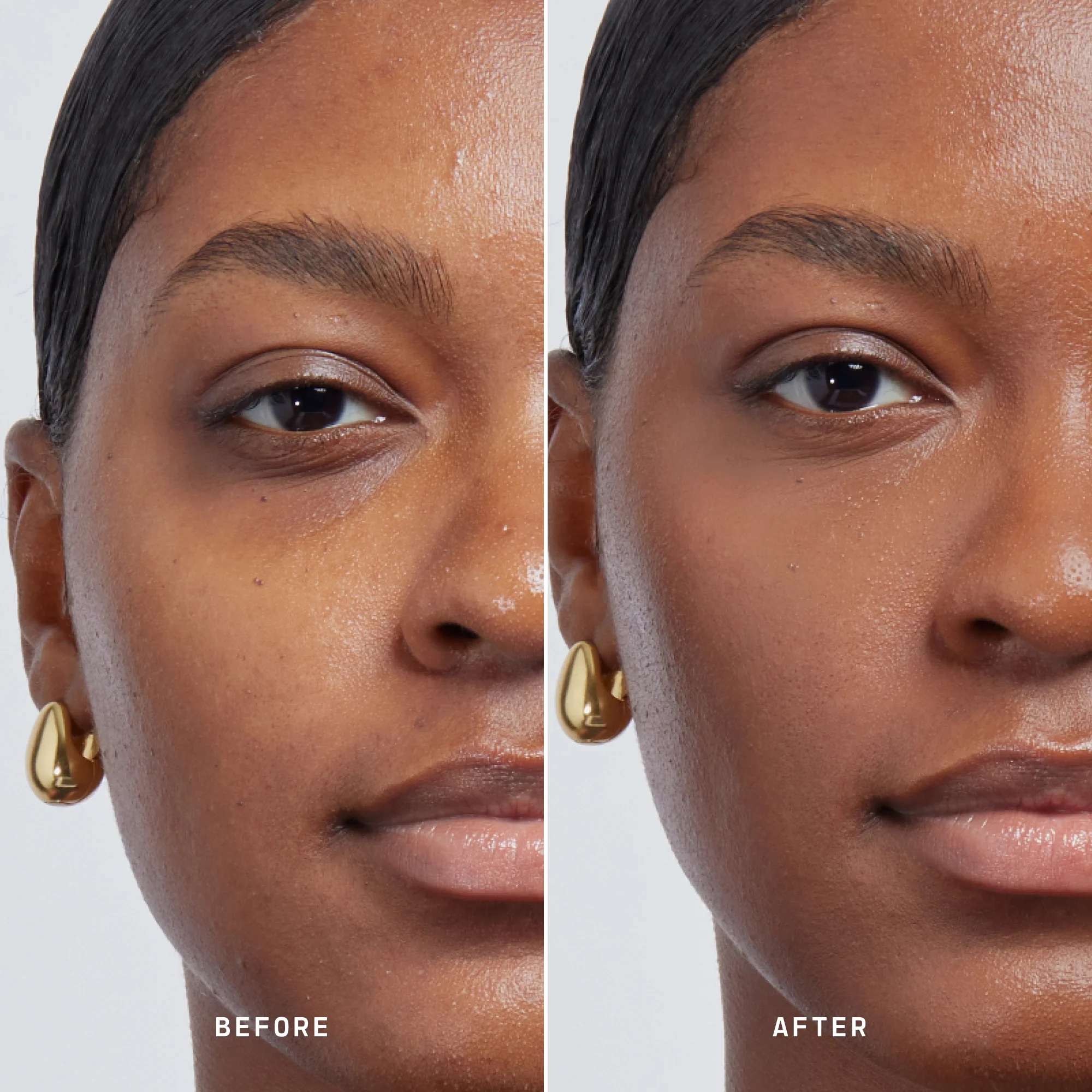 Skin Solution - Image 157