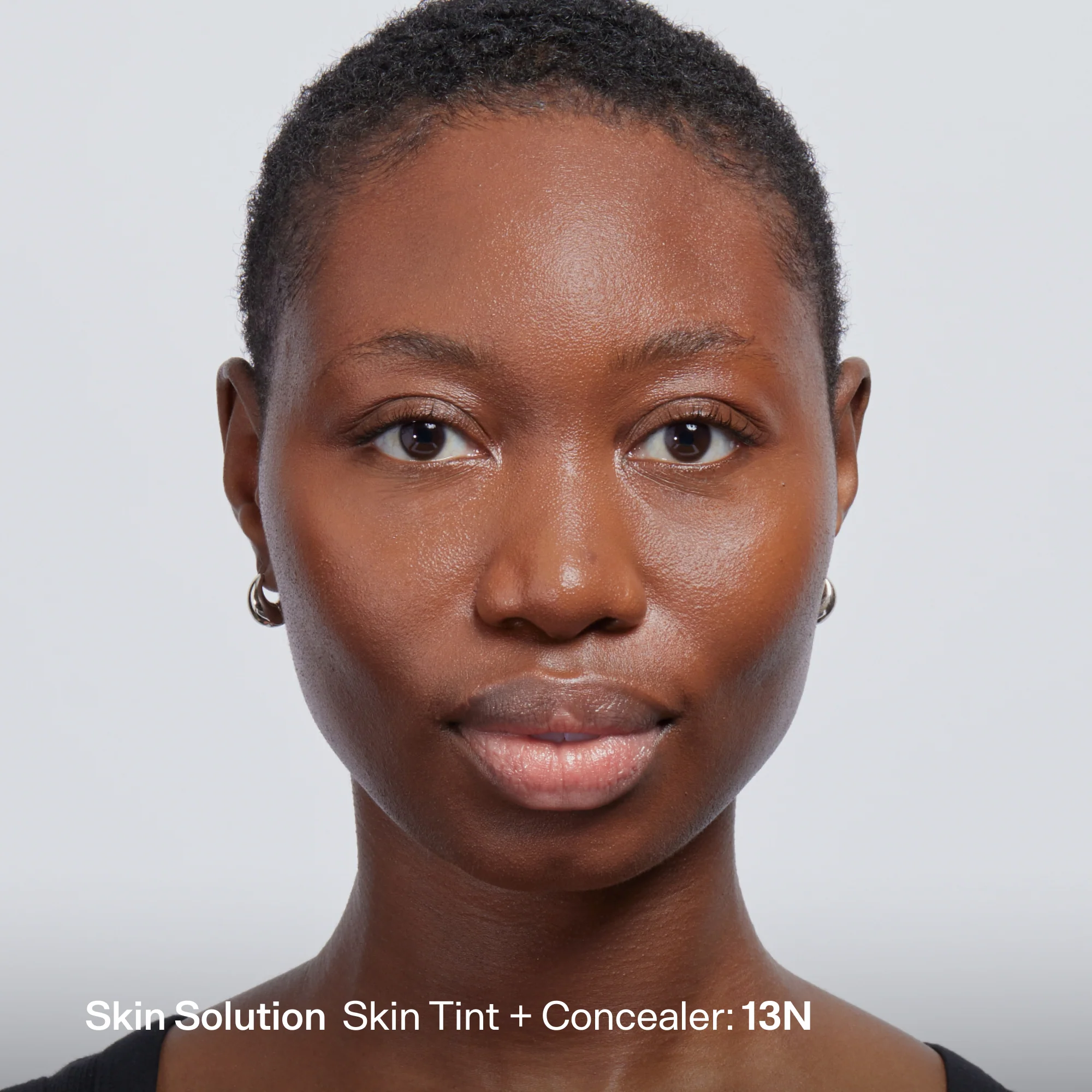Skin Solution - Image 172