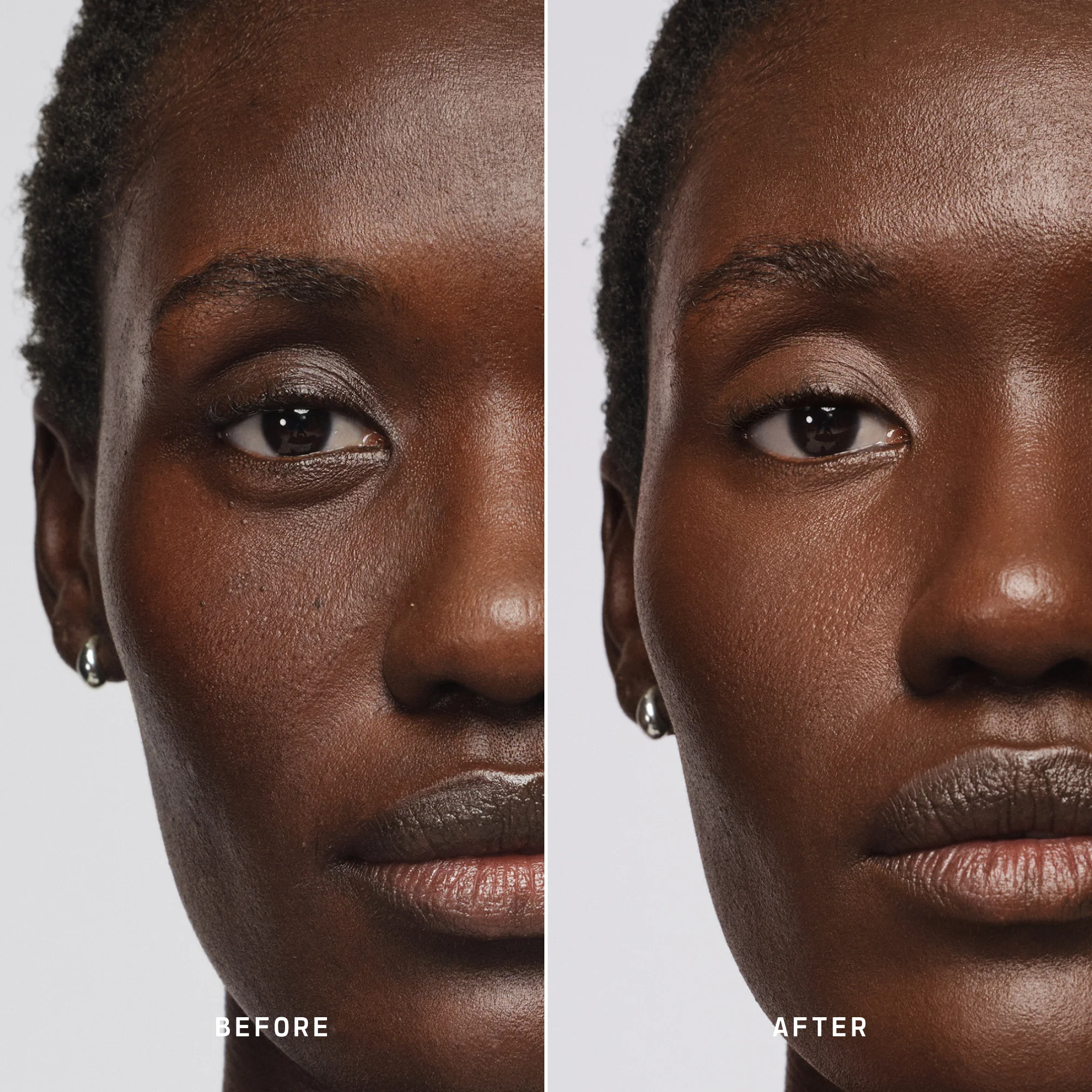 Skin Solution - Image 185