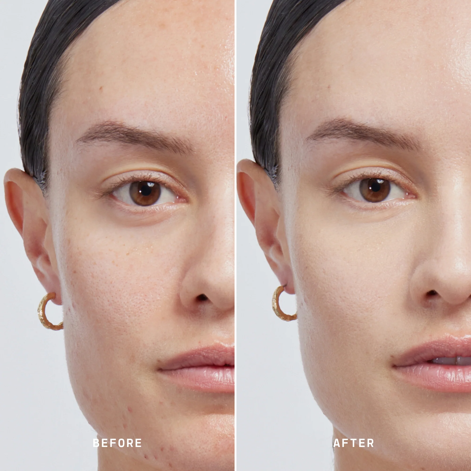 Skin Solution - Image 45