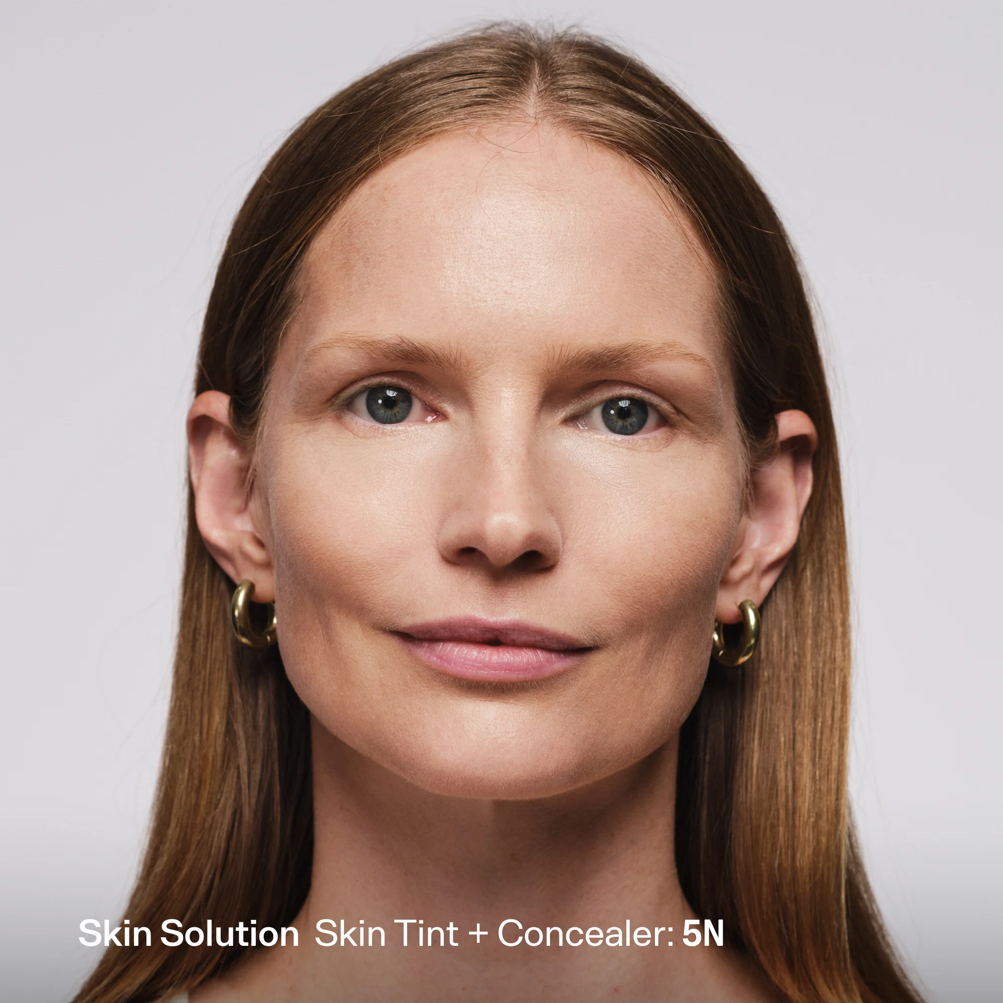 Skin Solution - Image 60