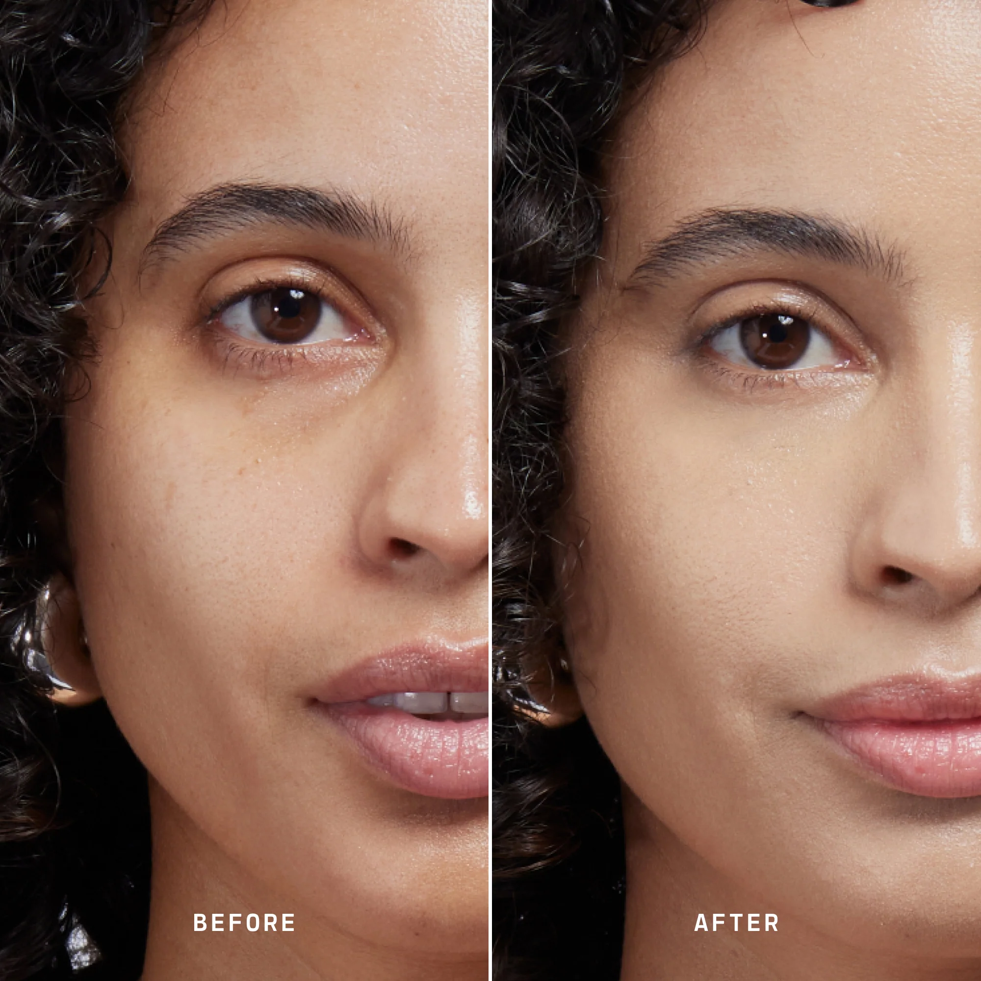 Skin Solution - Image 73