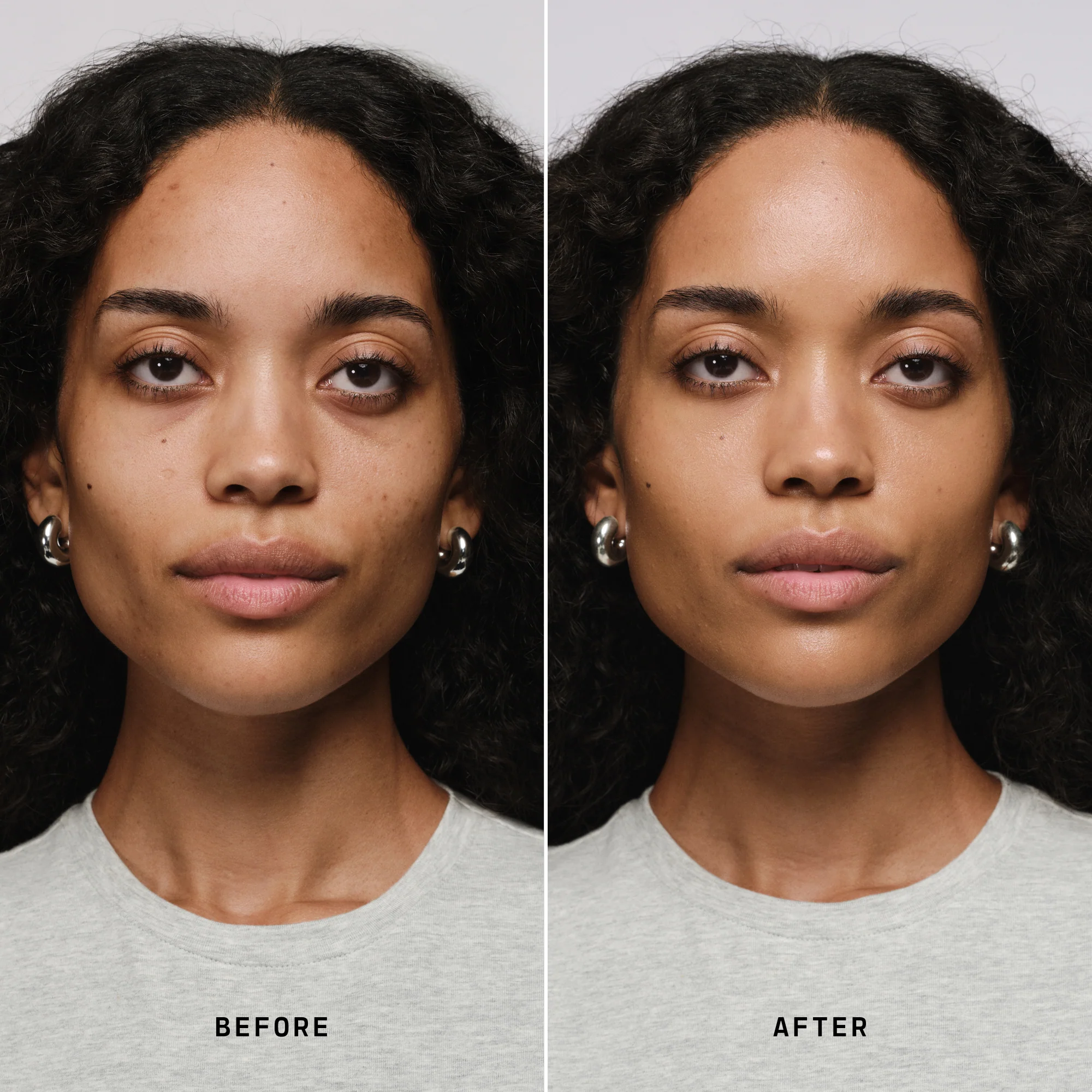 Skin Solution - Image 108