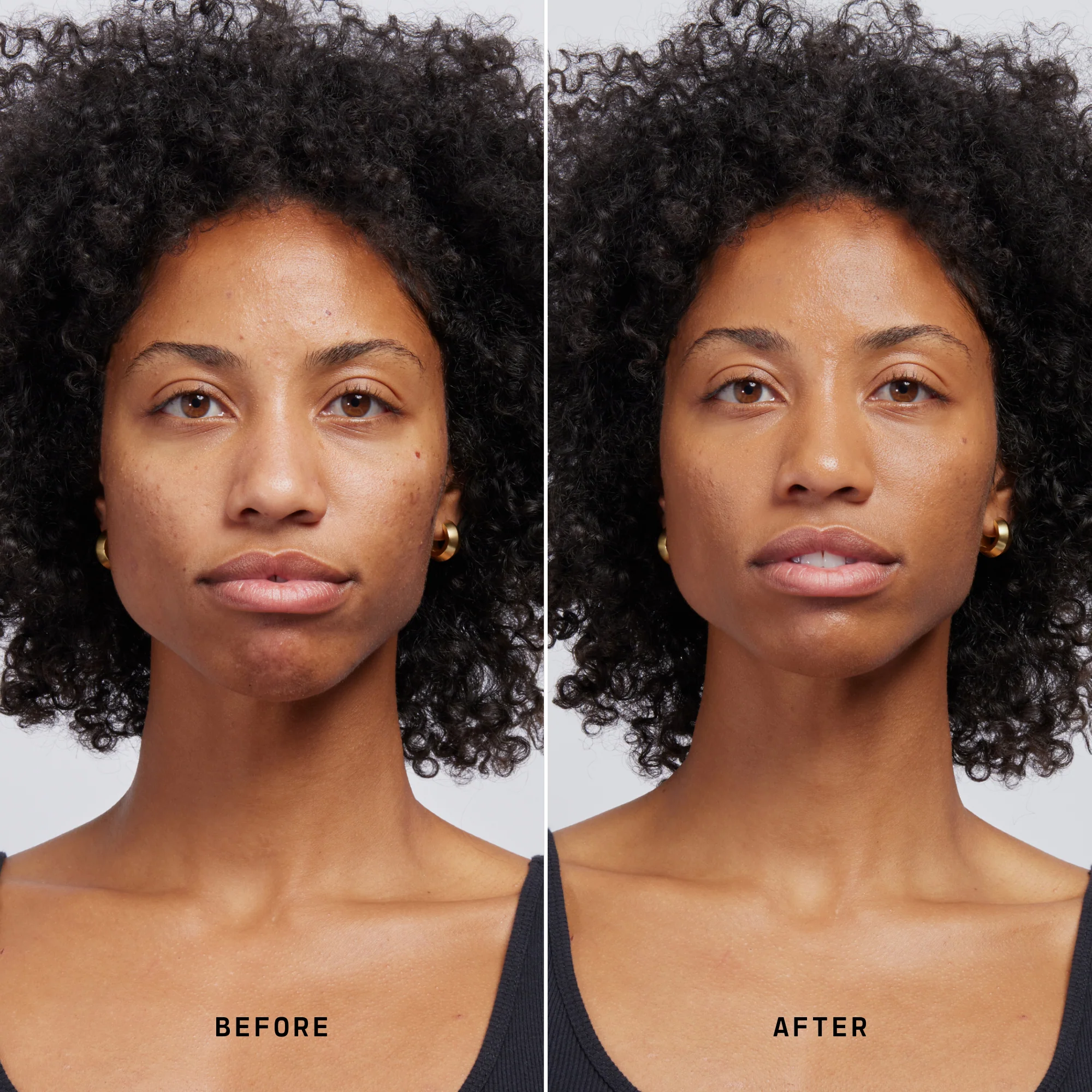 Skin Solution - Image 138