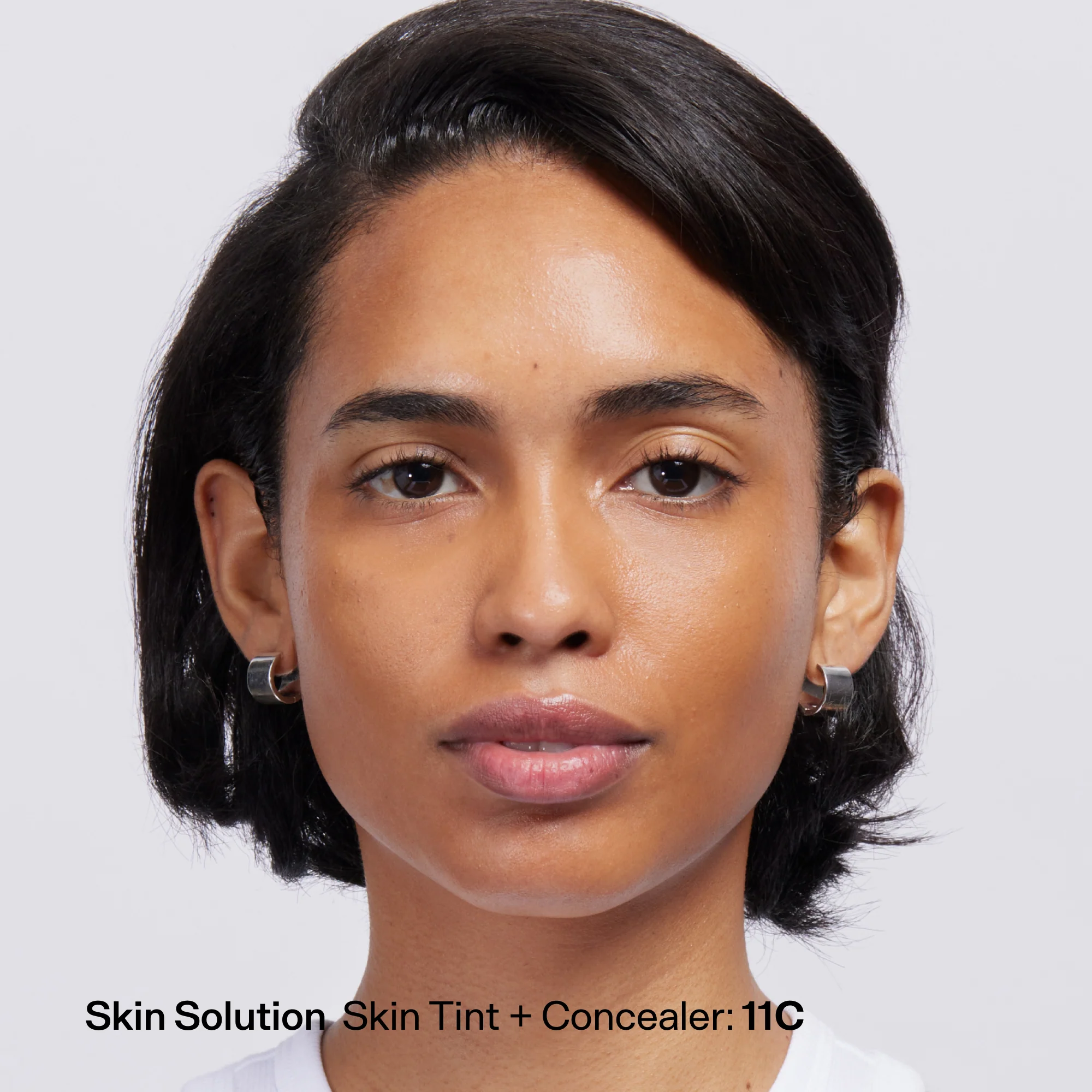 Skin Solution - Image 155