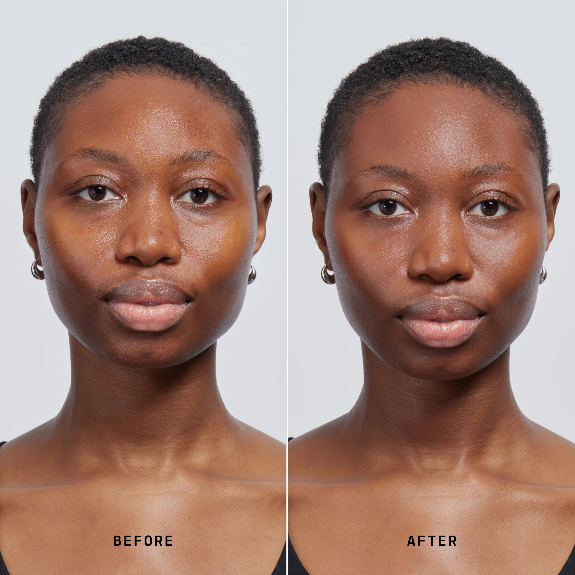 Skin Solution - Image 183