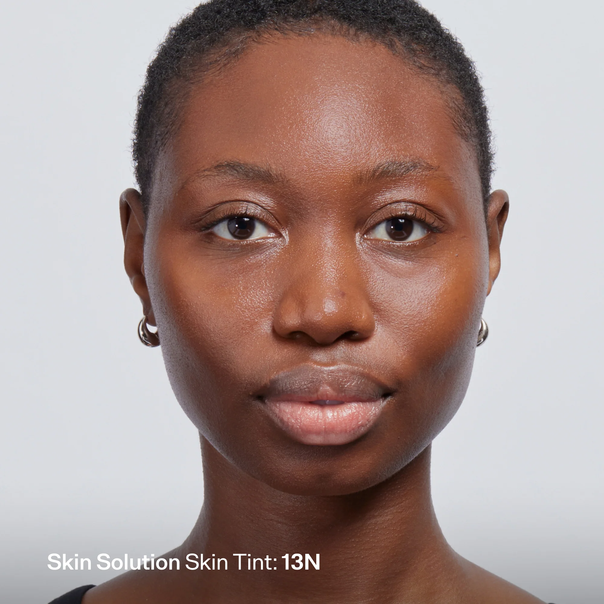 Skin Solution - Image 184