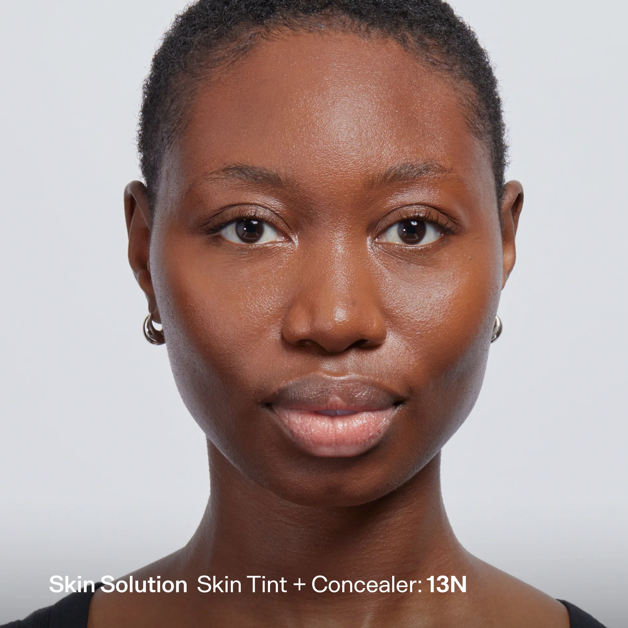 Skin Solution - Image 185