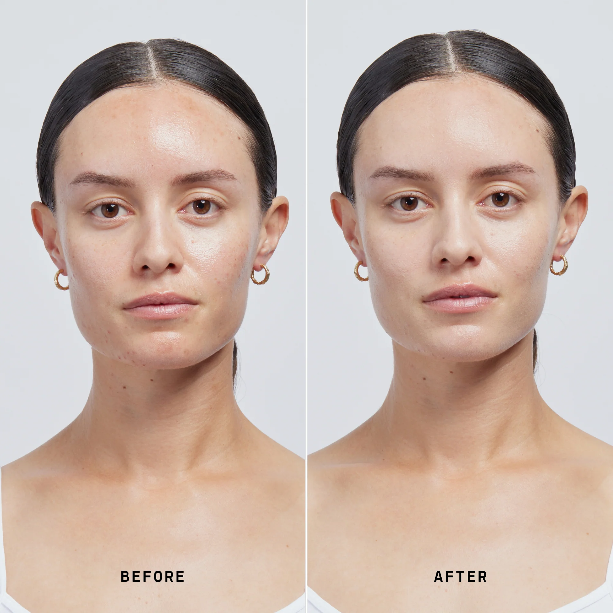 Skin Solution - Image 48