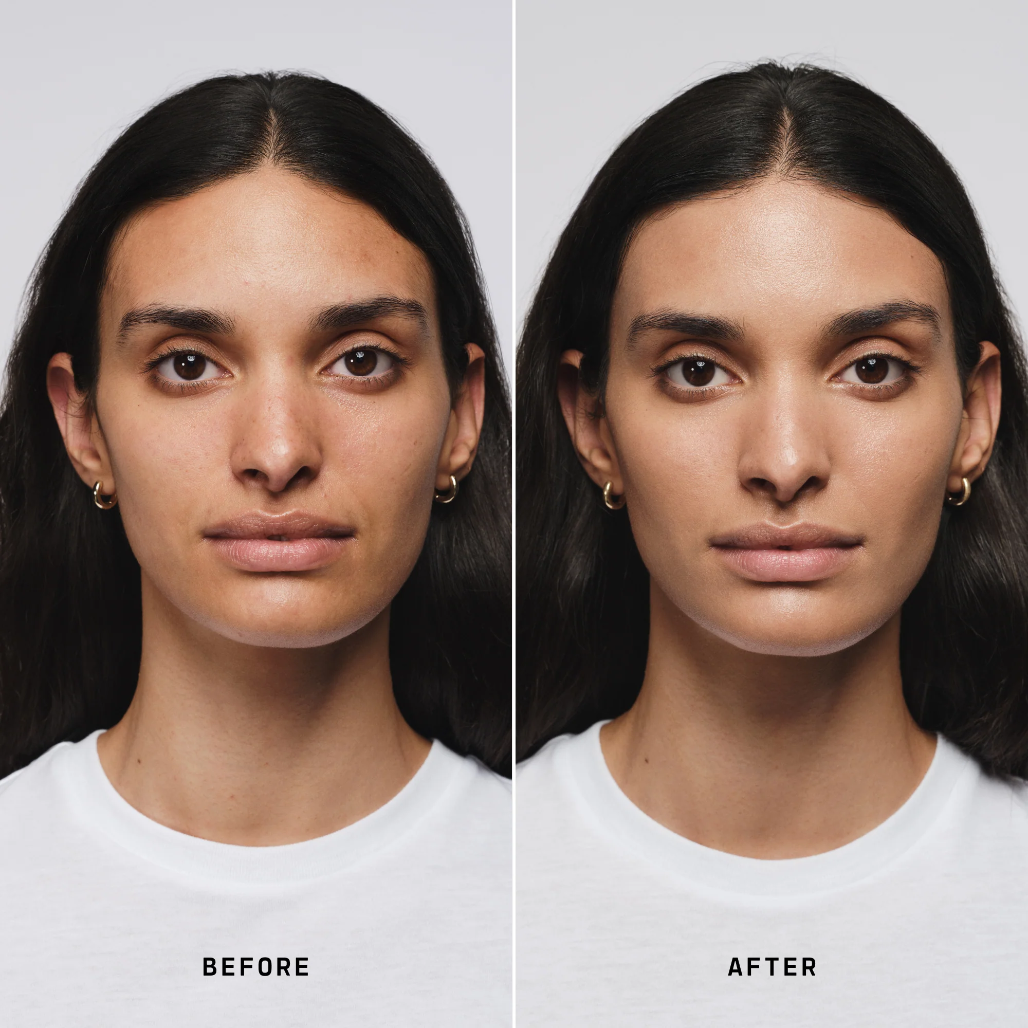 Skin Solution - Image 93
