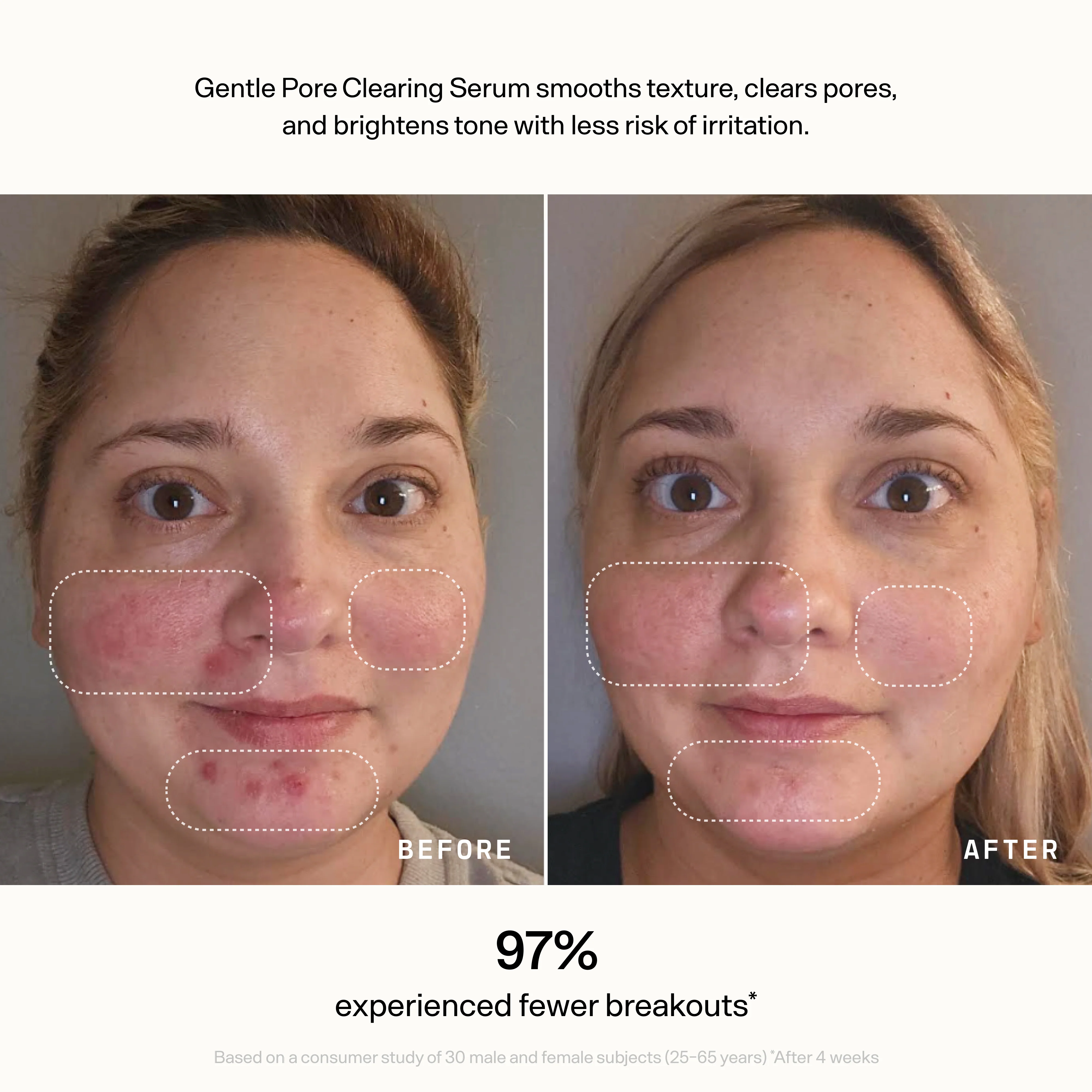 Face - Image 4
